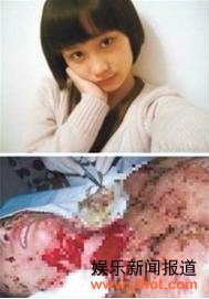 杨幂助力《梦想成真》帮助毁容少女周岩进京